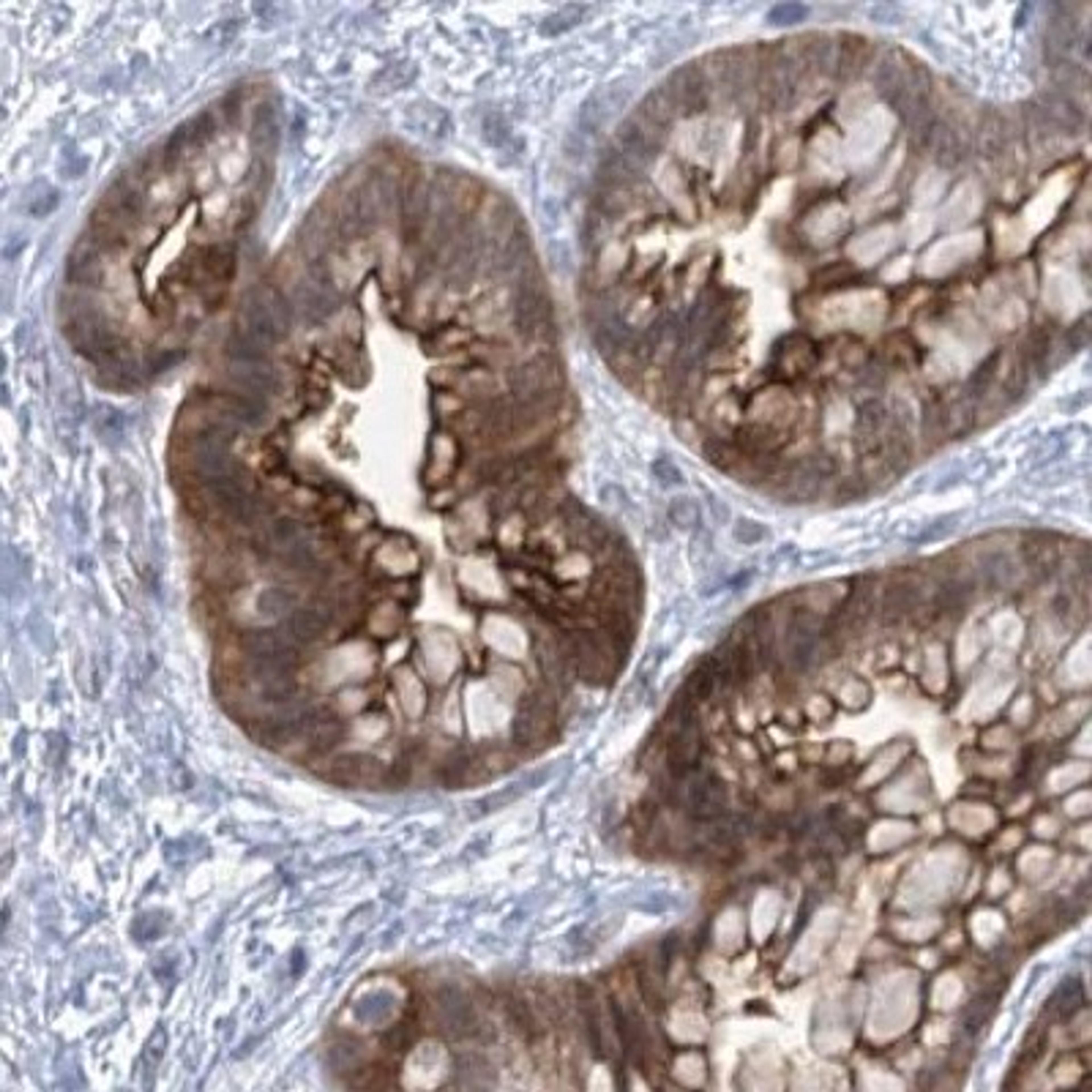 Immunohistochemistry: EPS8L1 Antibody [NBP2-32599] - Immunohistochemical staining of human placenta shows strong positivity in trophoblastic cells.