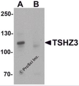 Western blot analysis of TSHZ3 in mouse brain tissue lysate with TSHZ3 antibody at 1 &#956;g/mL in (A) the absence and (B) the presence of blocking peptide.