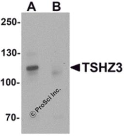 Western blot analysis of TSHZ3 in mouse brain tissue lysate with TSHZ3 antibody at 1 μg/mL in (A) the absence and (B) the presence of blocking peptide.