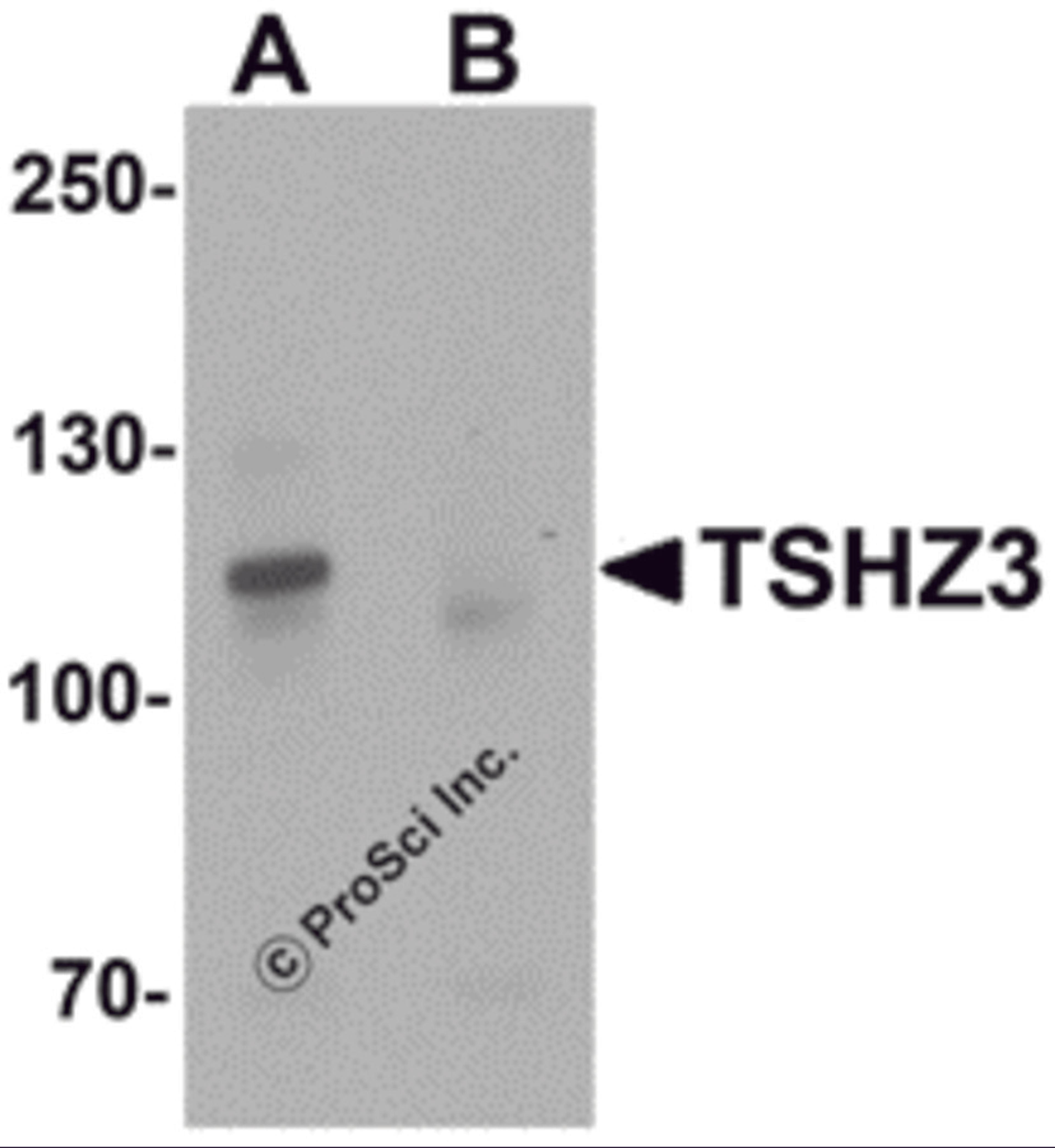 Western blot analysis of TSHZ3 in mouse brain tissue lysate with TSHZ3 antibody at 1 μg/mL in (A) the absence and (B) the presence of blocking peptide.