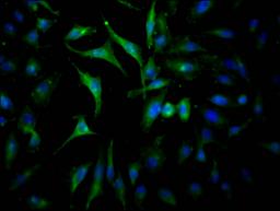 Immunofluorescence staining of Hela Cells with CSB-RA267127A0HU at 1:50, counter-stained with DAPI. The cells were fixed in 4% formaldehyde, permeated by 0.2% TritonX-100, and blocked in 10% normal Goat Serum. The cells were then incubated with the antibody overnight at 4℃. Nuclear DNA was labeled in blue with DAPI. The secondary antibody was FITC-conjugated AffiniPure Goat Anti-Rabbit IgG (H+L).