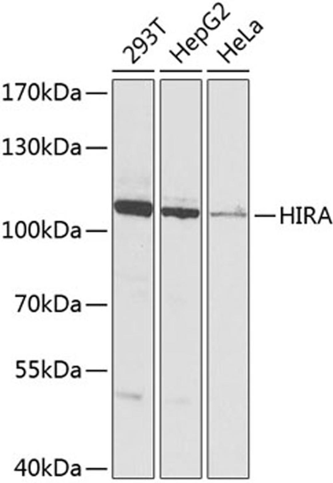 Western blot - HIRA antibody (A8461)