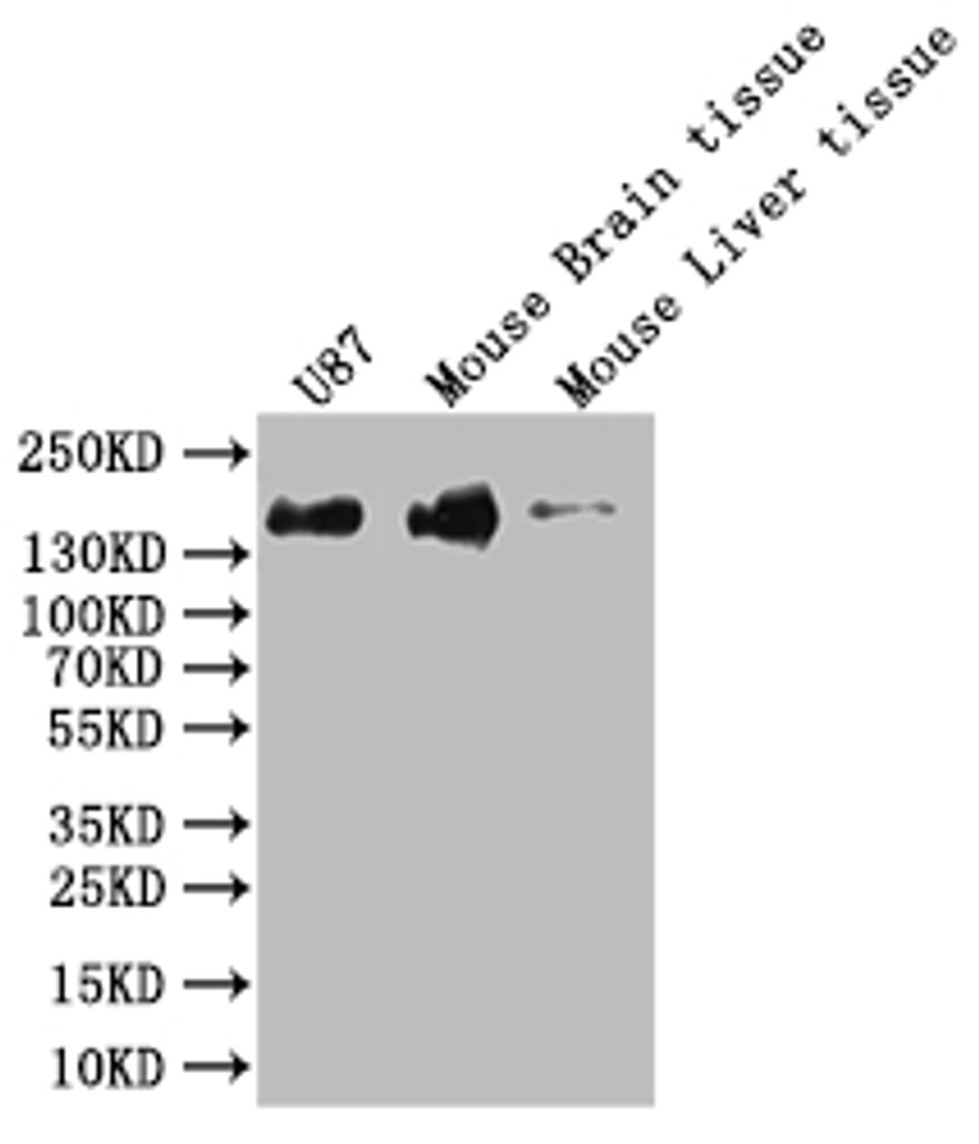 Western Blot. Positive WB detected in: Hela whole cell lysate, K562 whole cell lysate, U-87 whole cell lysate, Mouse Brain whole cell lysate. All lanes: SF3B1 antibody at 1:1000. Secondary. Goat polyclonal to rabbit IgG at 1/50000 dilution. Predicted band size: 146, 17 kDa. Observed band size: 130 kDa. 