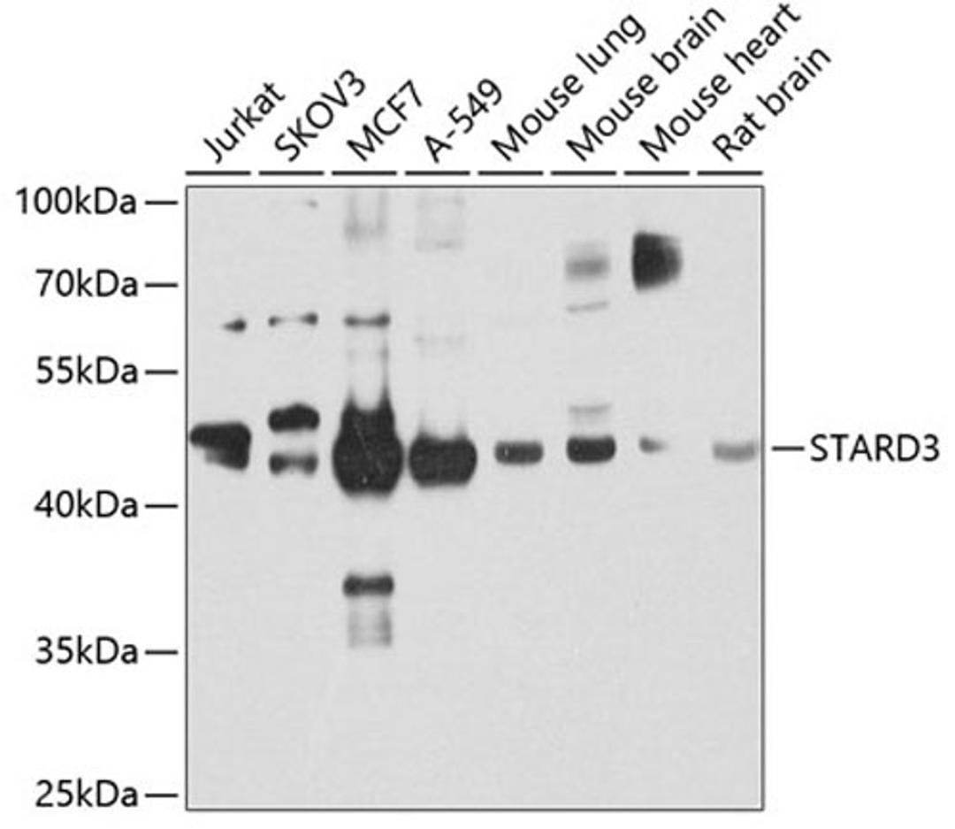 Western blot - STARD3 antibody (A7776)