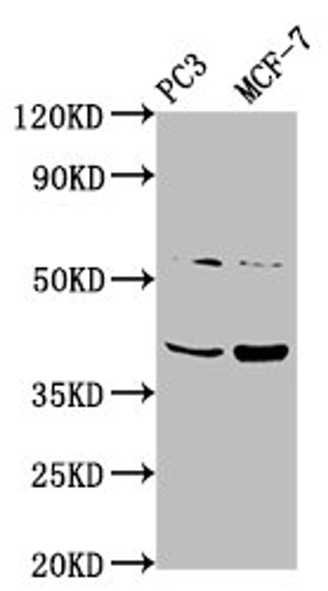 Western Blot. Positive WB detected in: PC-3 whole cell lysate, MCF-7 whole cell lysate. All lanes: PCGF6 antibody at 3.1ug/ml. Secondary. Goat polyclonal to rabbit IgG at 1/50000 dilution. Predicted band size: 40, 31 kDa. Observed band size: 40 kDa.
