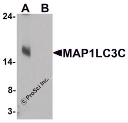 Western blot analysis of MAP1LC3C in human brain tissue lysate with MAP1LC3C antibody at 1 &#956;g/ml in (A) the absence and (B) the presence of blocking peptide.