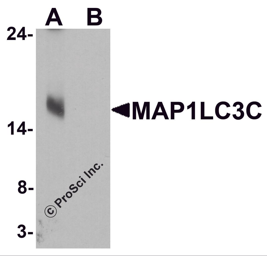 Western blot analysis of MAP1LC3C in human brain tissue lysate with MAP1LC3C antibody at 1 μg/ml in (A) the absence and (B) the presence of blocking peptide.