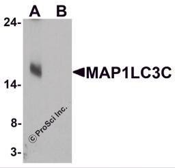 Western blot analysis of MAP1LC3C in human brain tissue lysate with MAP1LC3C antibody at 1 μg/ml in (A) the absence and (B) the presence of blocking peptide.