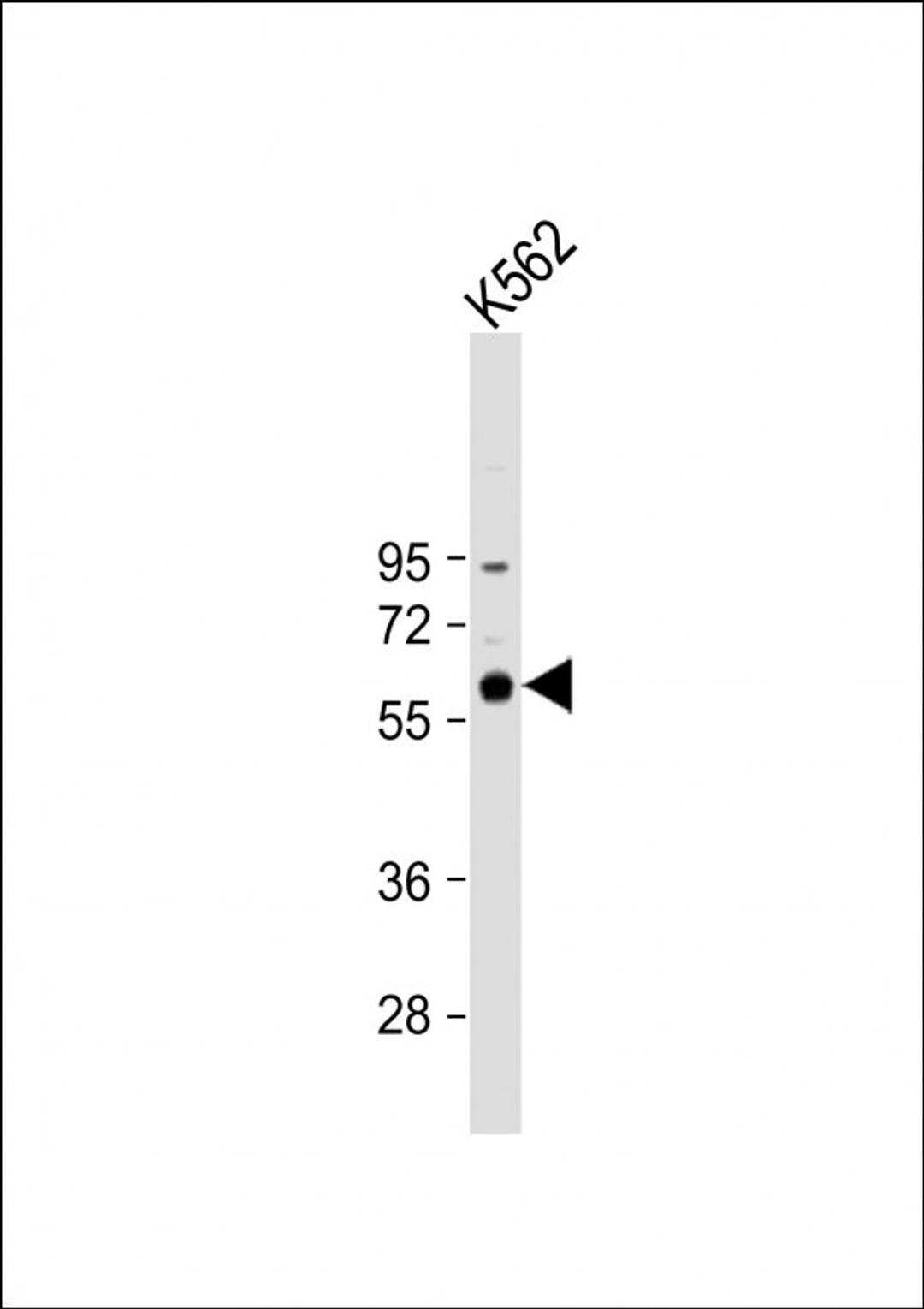 Western Blot at 1:1000 dilution + K562 whole cell lysate Lysates/proteins at 20 ug per lane.