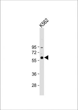 Western Blot at 1:1000 dilution + K562 whole cell lysate Lysates/proteins at 20 ug per lane.