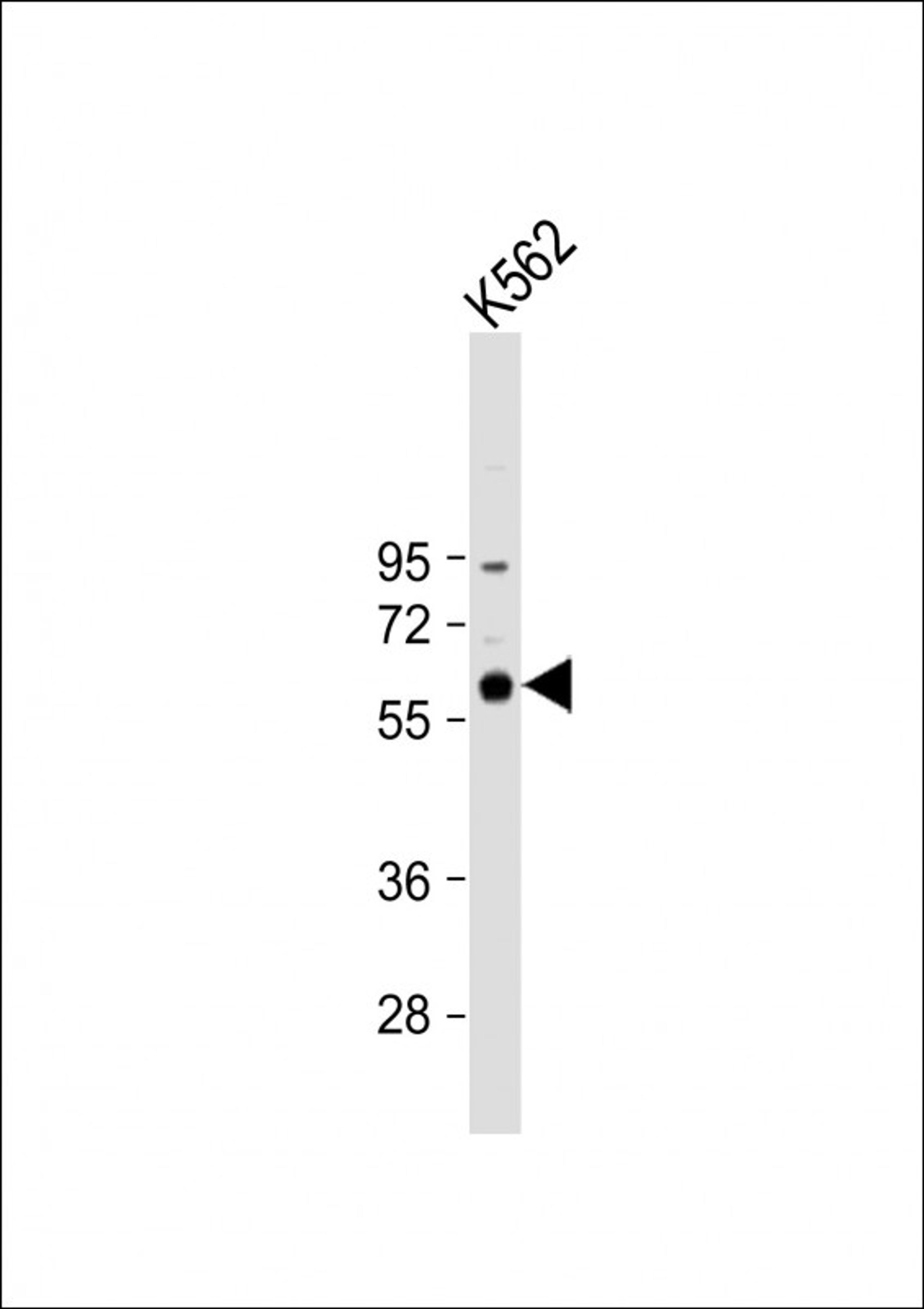 Western Blot at 1:1000 dilution + K562 whole cell lysate Lysates/proteins at 20 ug per lane.