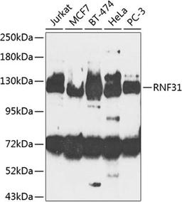 Western blot - RNF31 antibody (A8227)