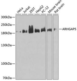 Western blot - ARHGAP5 antibody (A3587)