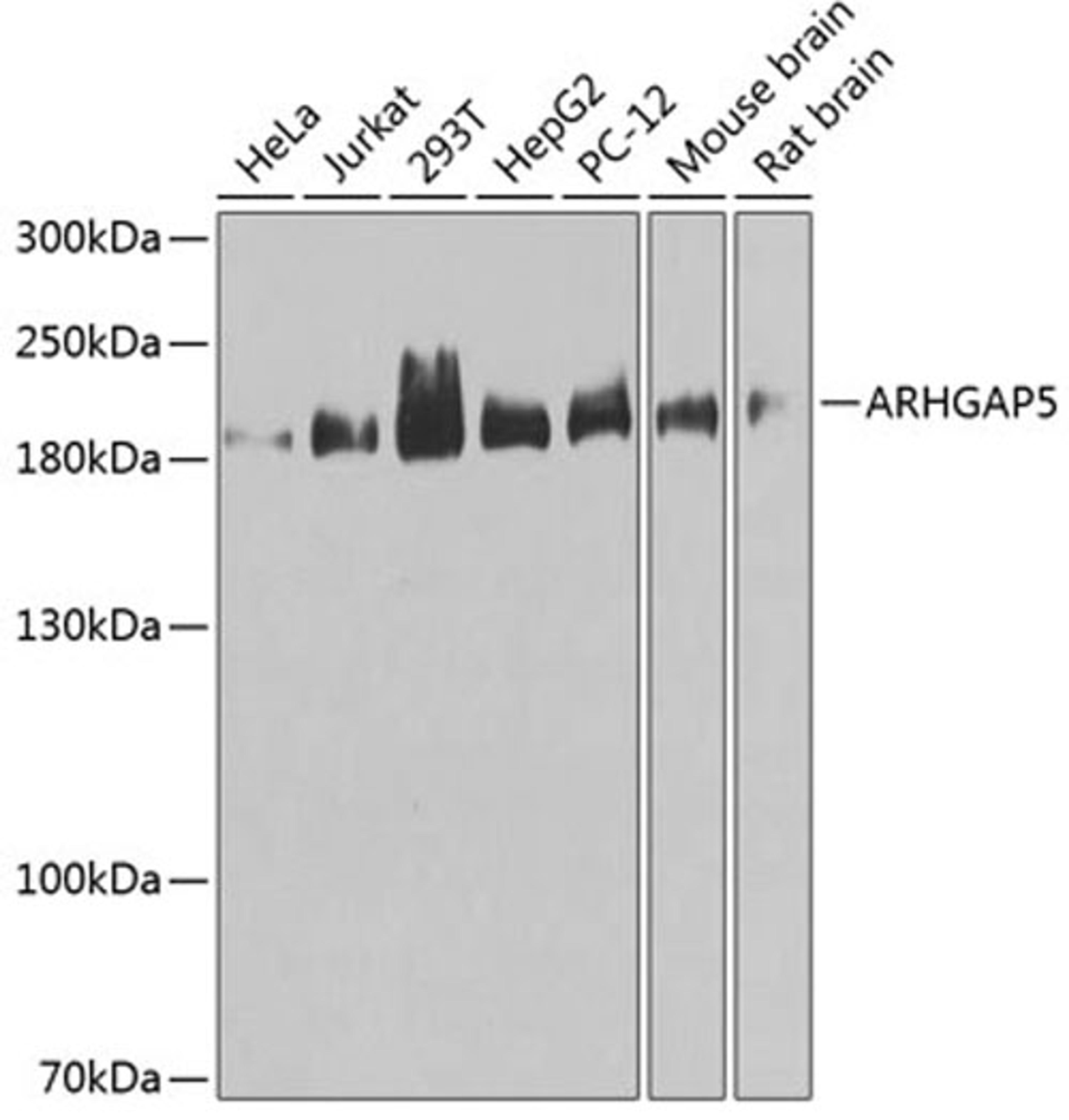 Western blot - ARHGAP5 antibody (A3587)