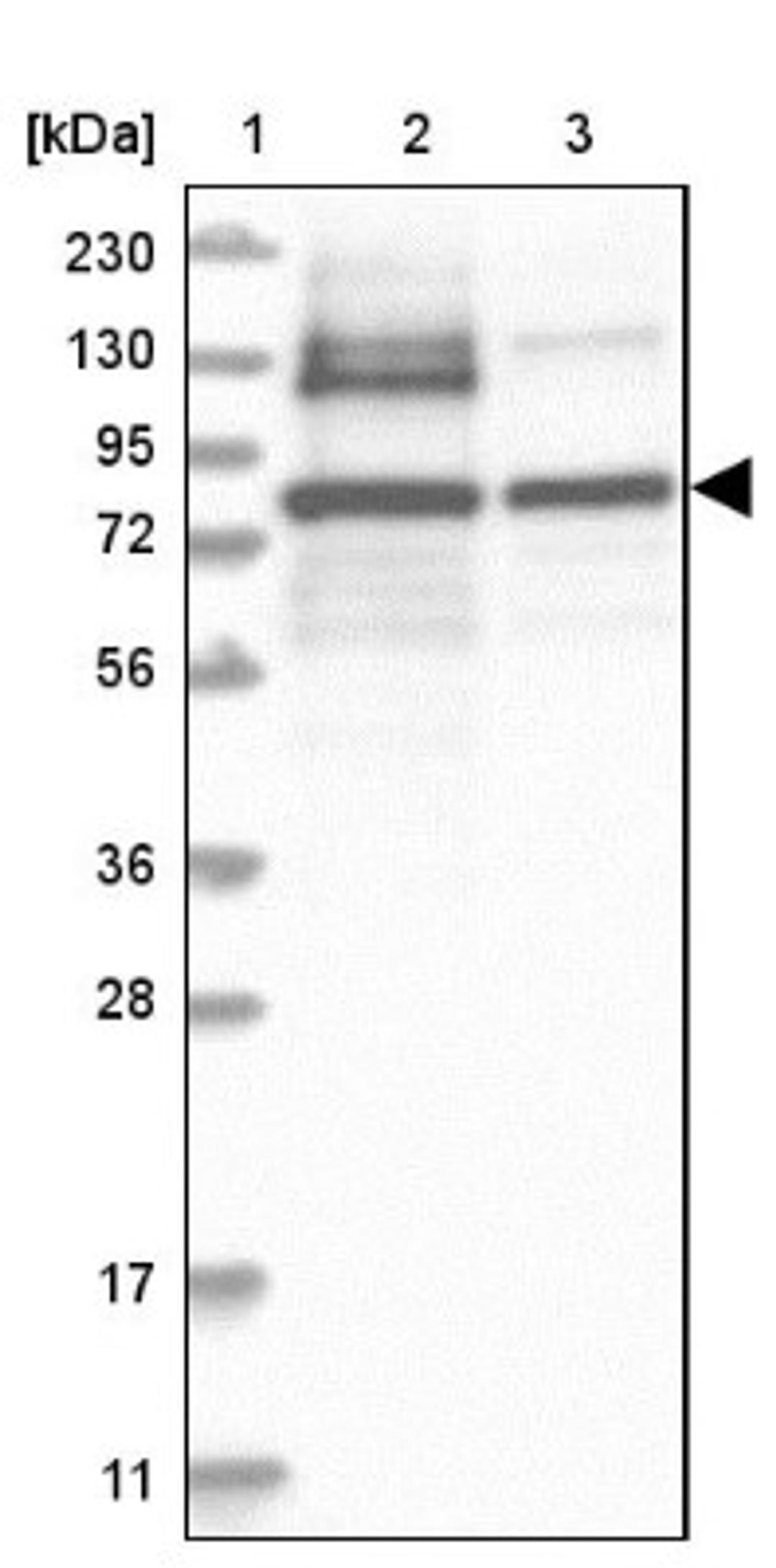 Western Blot: PNPT1 Antibody [NBP1-82485] - Lane 1: Marker [kDa] 230, 130, 95, 72, 56, 36, 28, 17, 11<br/>Lane 2: Human cell line RT-4<br/>Lane 3: Human cell line U-251MG sp