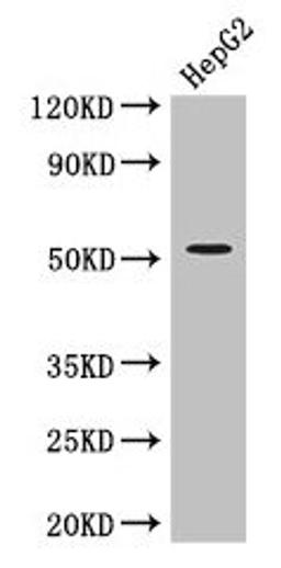 Western Blot. Positive WB detected in: HepG2 whole cell lysate. All lanes: DAPK3 antibody at 3.4µg/ml. Secondary. Goat polyclonal to rabbit IgG at 1/50000 dilution. Predicted band size: 53, 38 kDa. Observed band size: 53 kDa
