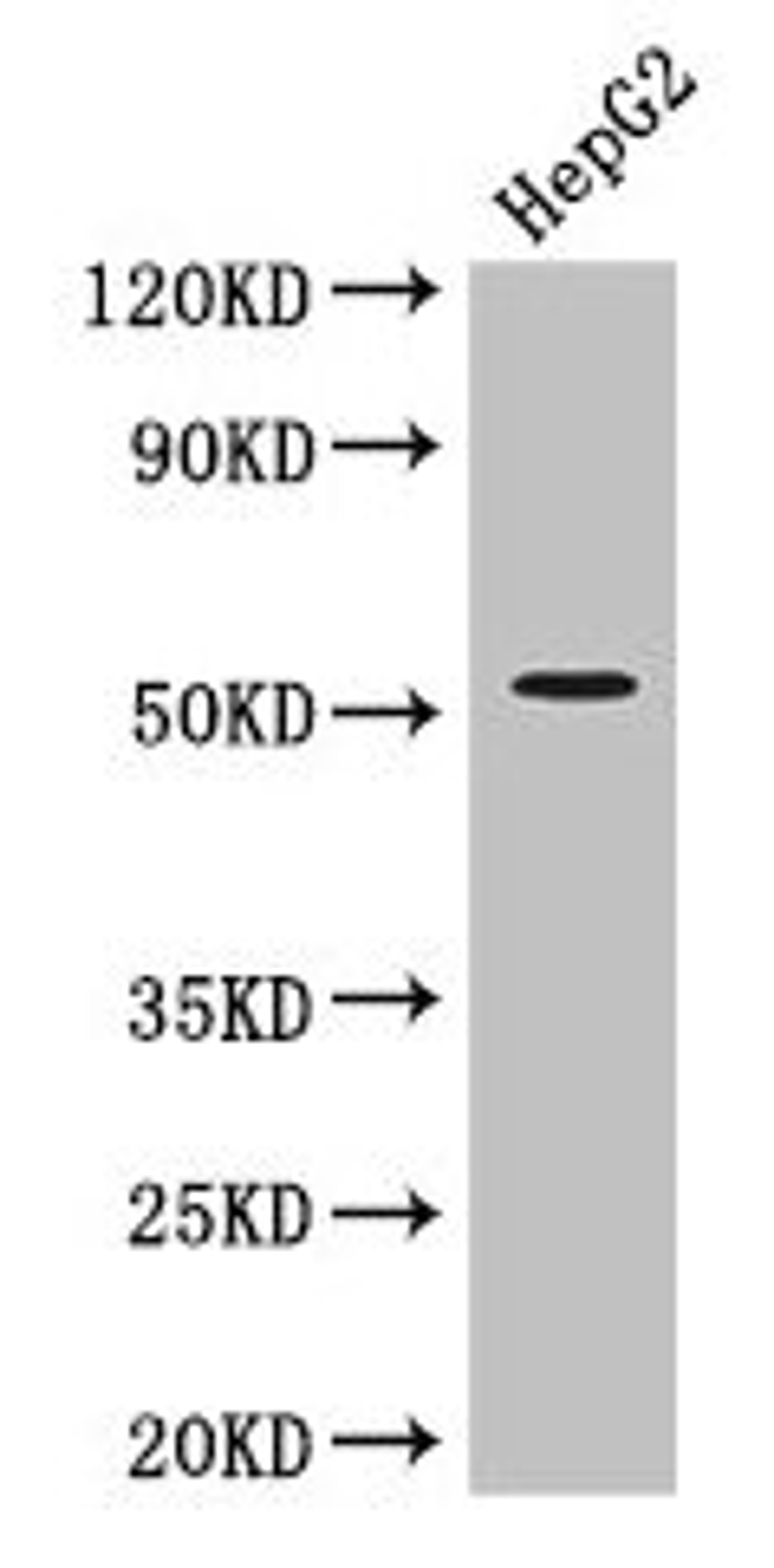 Western Blot. Positive WB detected in: HepG2 whole cell lysate. All lanes: DAPK3 antibody at 3.4µg/ml. Secondary. Goat polyclonal to rabbit IgG at 1/50000 dilution. Predicted band size: 53, 38 kDa. Observed band size: 53 kDa