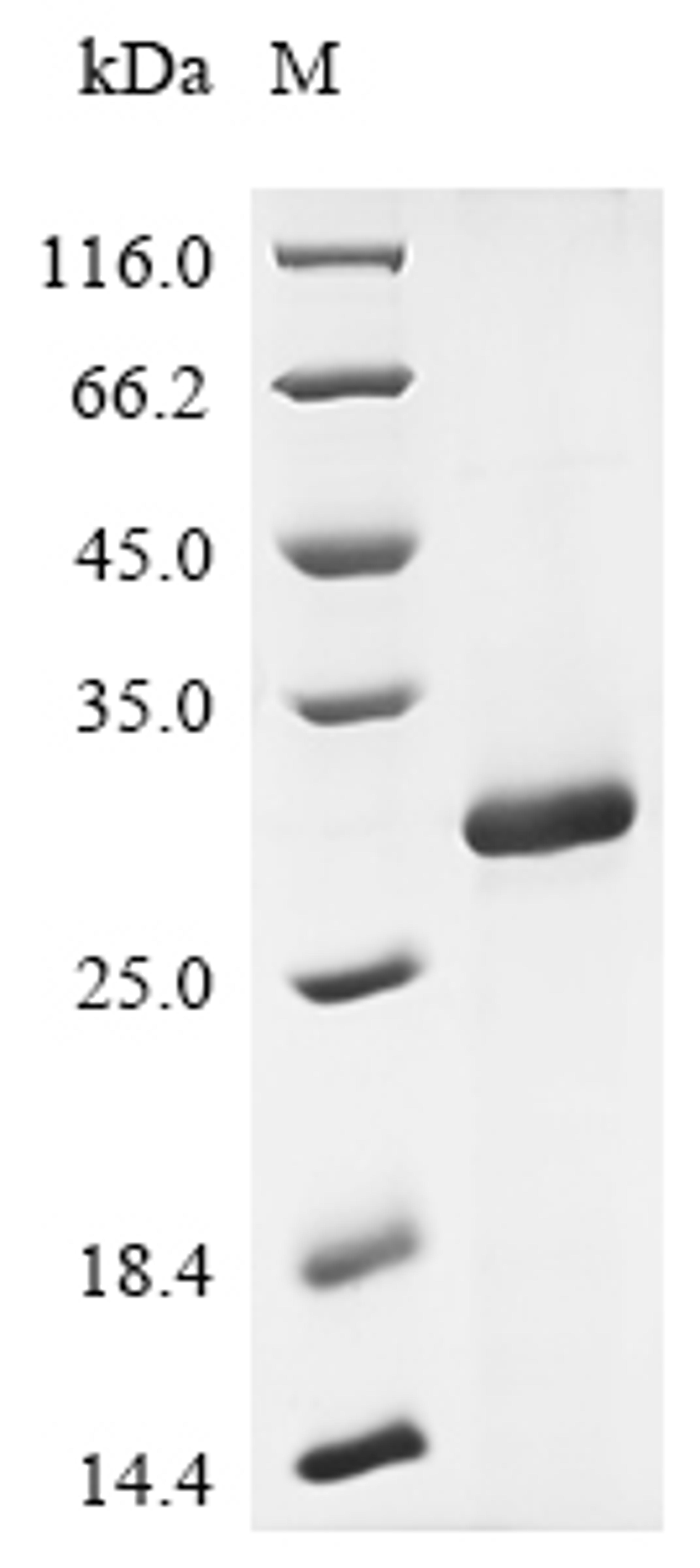 (Tris-Glycine gel) Discontinuous SDS-PAGE (reduced) with 5% enrichment gel and 15% separation gel.