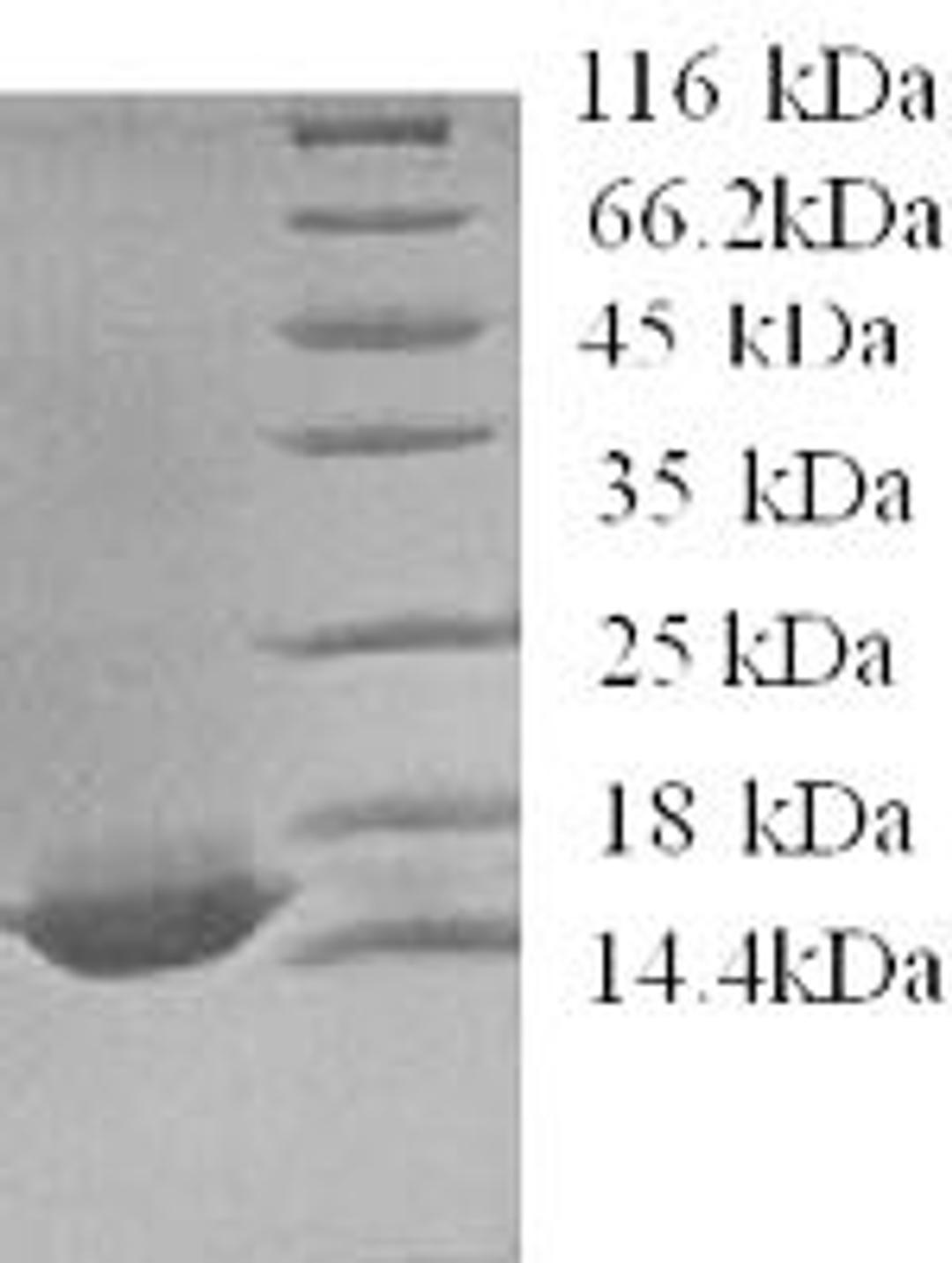 (Tris-Glycine gel) Discontinuous SDS-PAGE (reduced) with 5% enrichment gel and 15% separation gel.