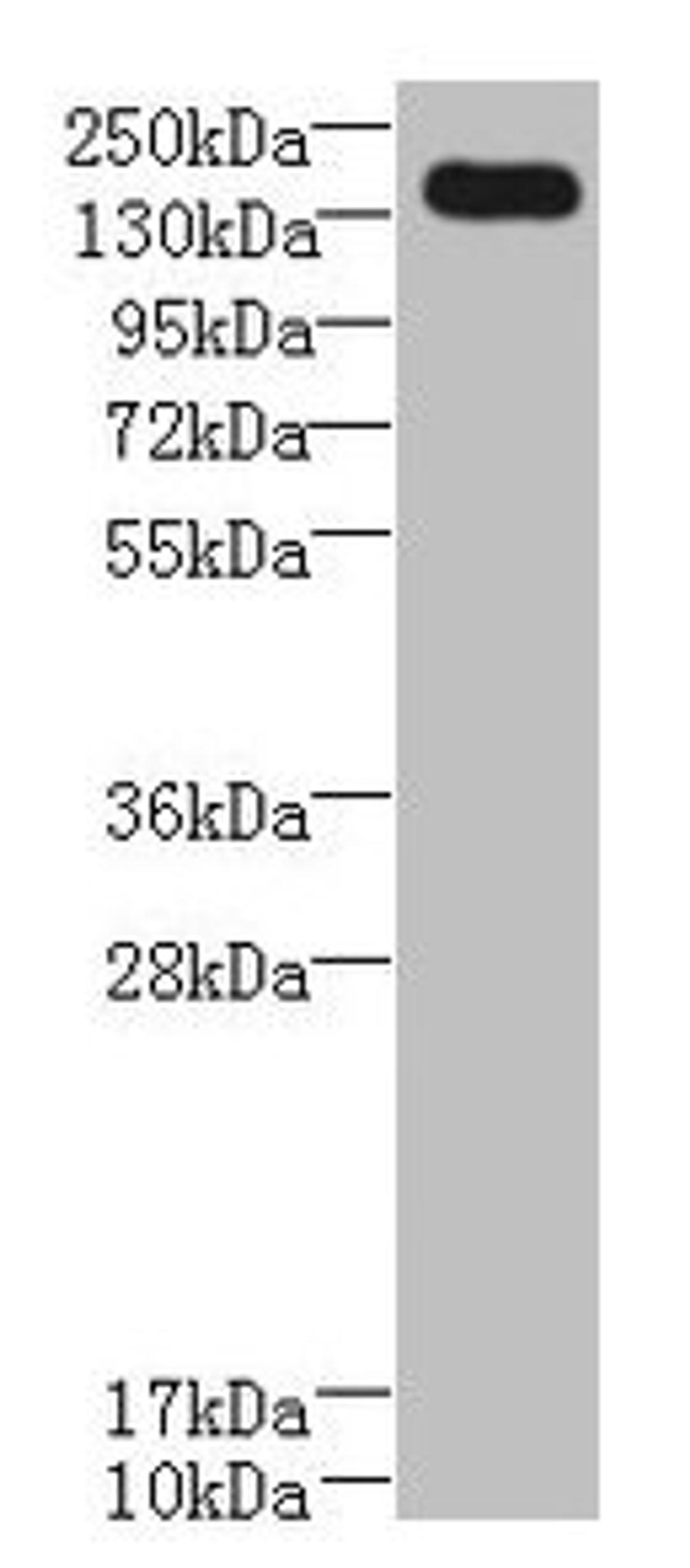 Western blot. All lanes: UBE2O antibody at 0.8µg/ml + A431 whole cell lysate. Secondary. Goat polyclonal to rabbit IgG at 1/10000 dilution. Predicted band size: 142 kDa. Observed band size: 142 kDa