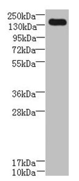 Western blot. All lanes: UBE2O antibody at 0.8µg/ml + A431 whole cell lysate. Secondary. Goat polyclonal to rabbit IgG at 1/10000 dilution. Predicted band size: 142 kDa. Observed band size: 142 kDa