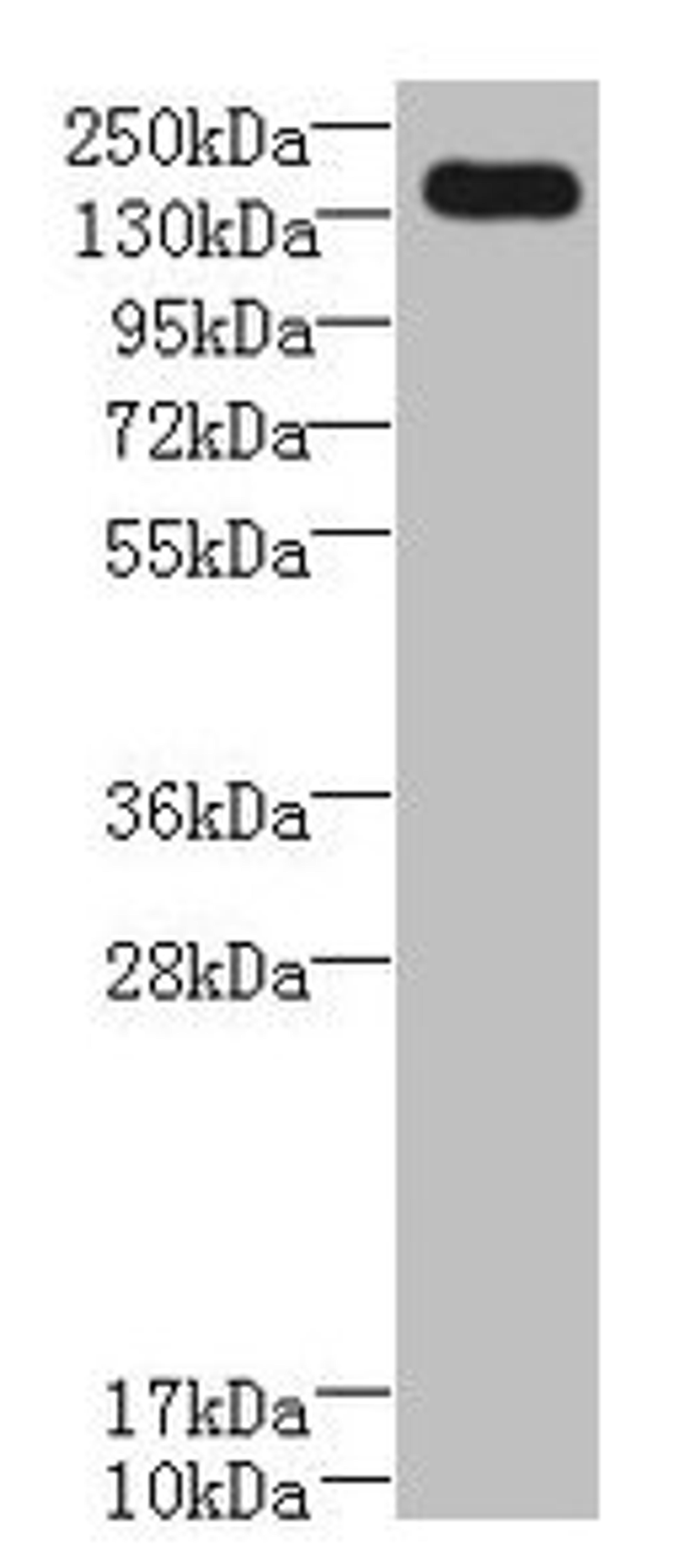 Western blot. All lanes: UBE2O antibody at 0.8µg/ml + A431 whole cell lysate. Secondary. Goat polyclonal to rabbit IgG at 1/10000 dilution. Predicted band size: 142 kDa. Observed band size: 142 kDa