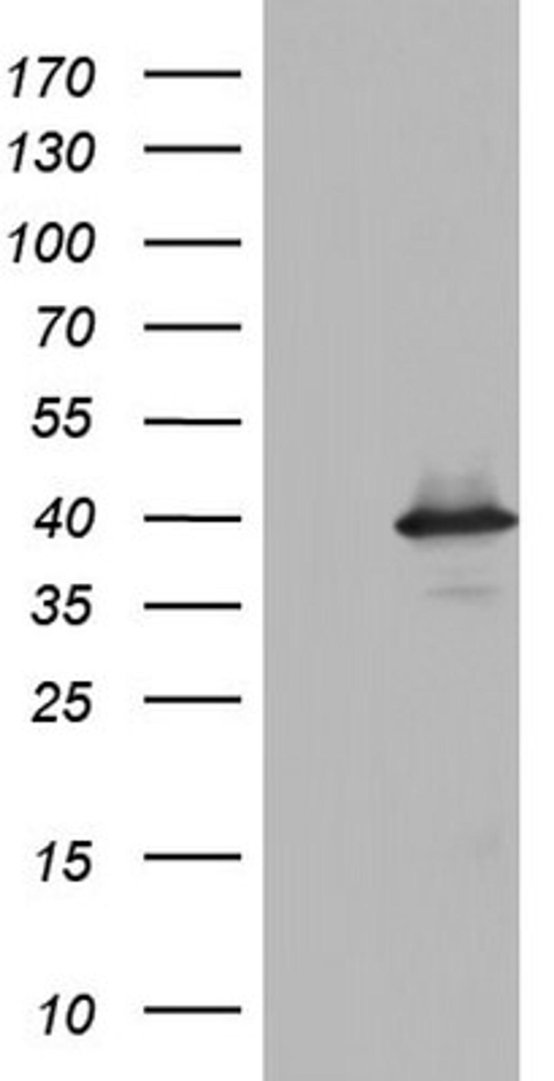 Western Blot: UFD1L Antibody (8G6) [NBP2-46289] - Analysis of HEK293T cells were transfected with the pCMV6-ENTRY control (Left lane) or pCMV6-ENTRY UFD1L.