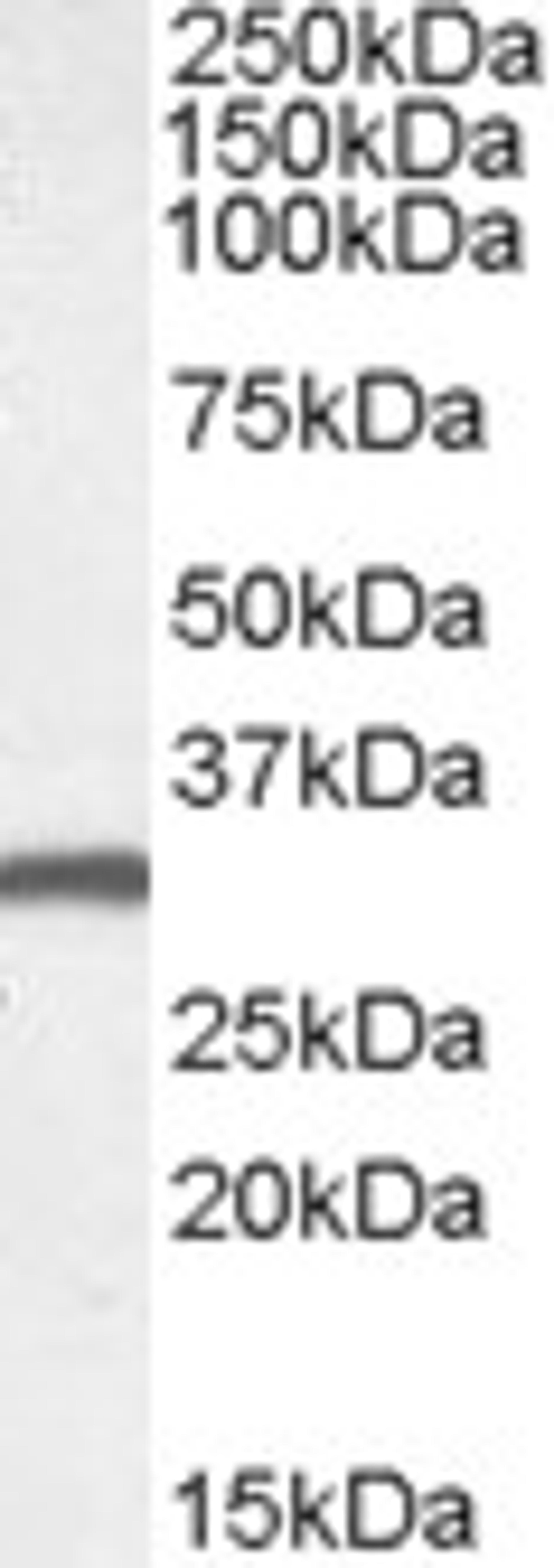 45-537 (1ug/ml) staining of Mouse Brain lysate (35ug protein in RIPA buffer). Primary incubation was 1 hour. Detected by chemiluminescence.