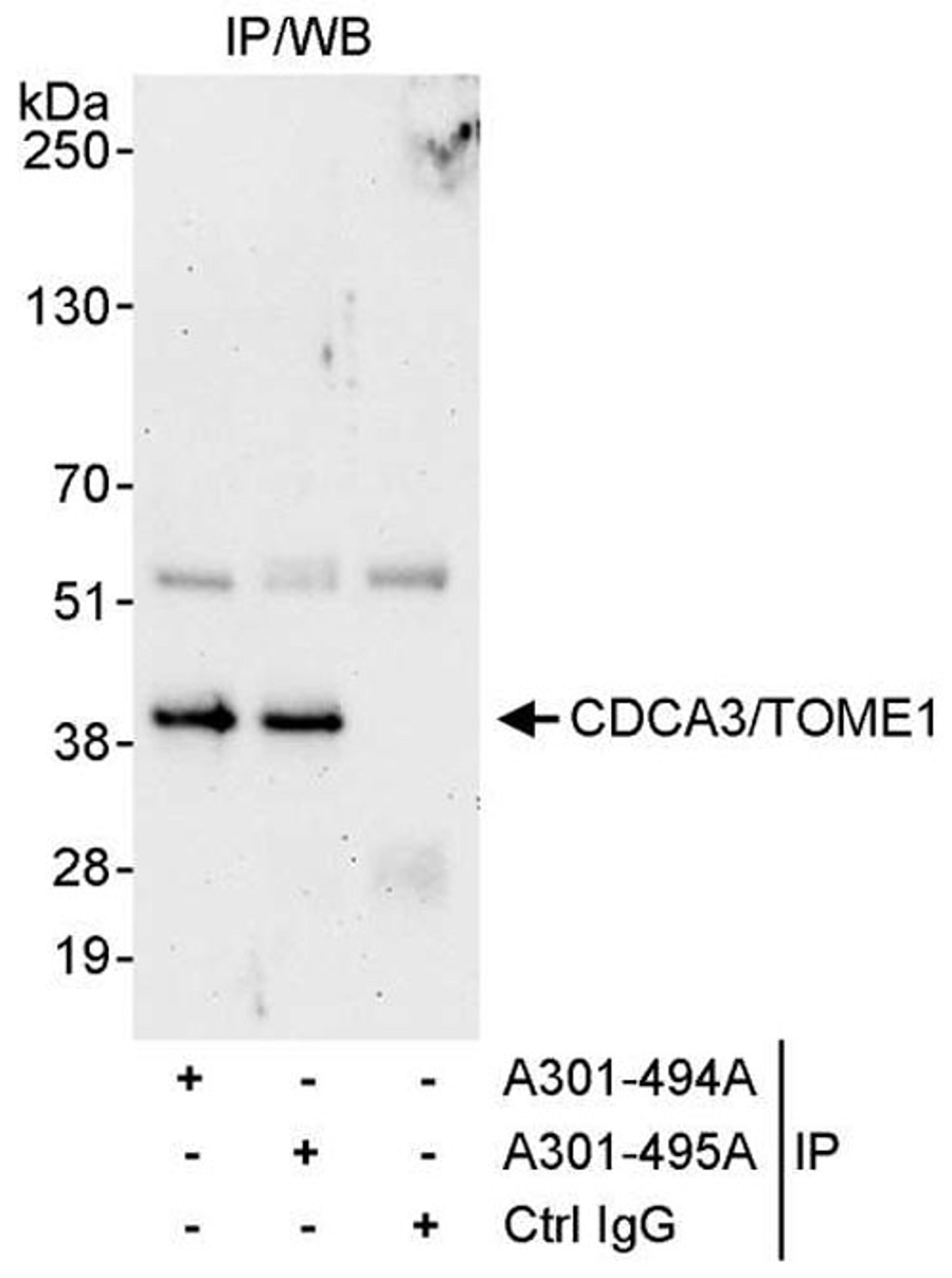 Detection of human CDCA3/TOME1 by WB of IP.