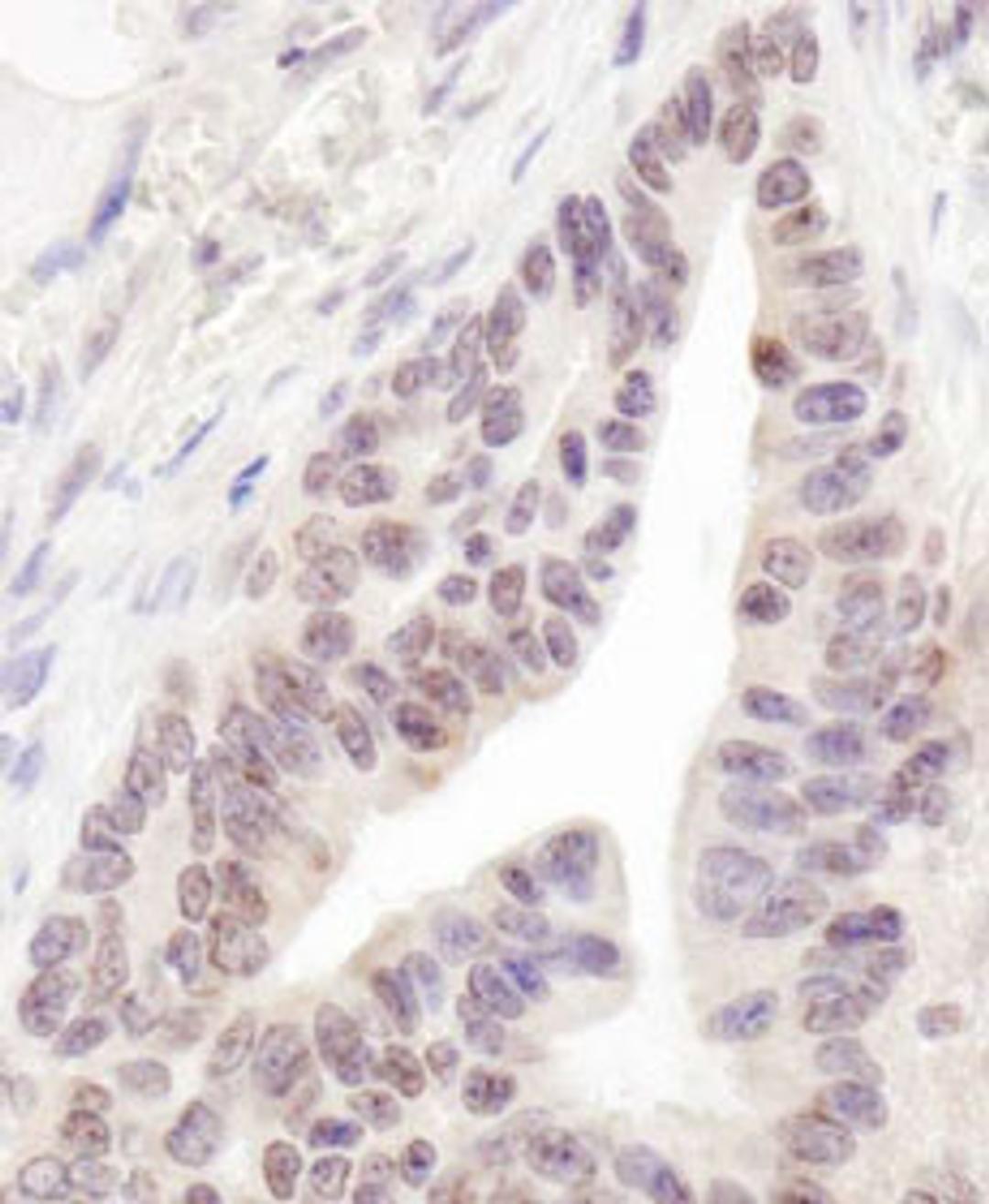 Detection of human RBM12 by immunohistochemistry.