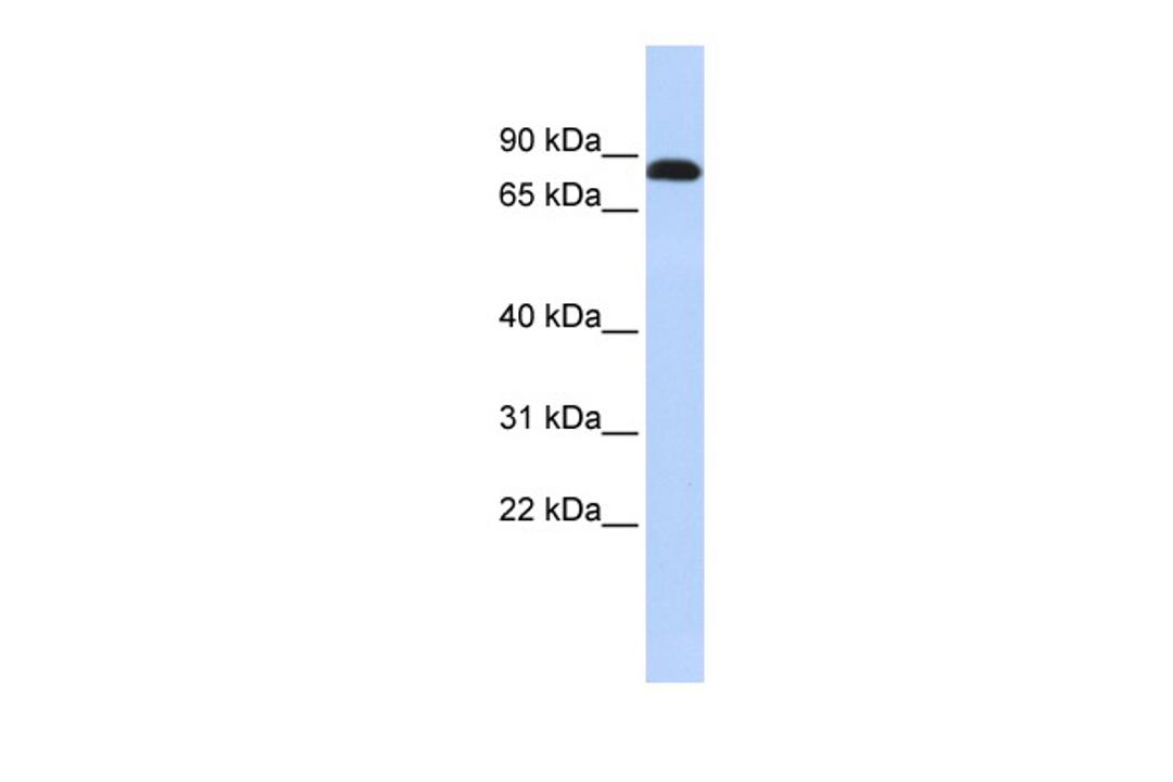 Antibody used in WB on Human Jurkat 0.2-1 ug/ml.