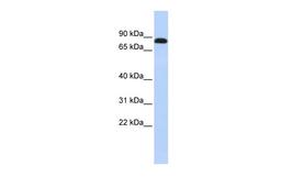 Antibody used in WB on Human Jurkat 0.2-1 ug/ml.