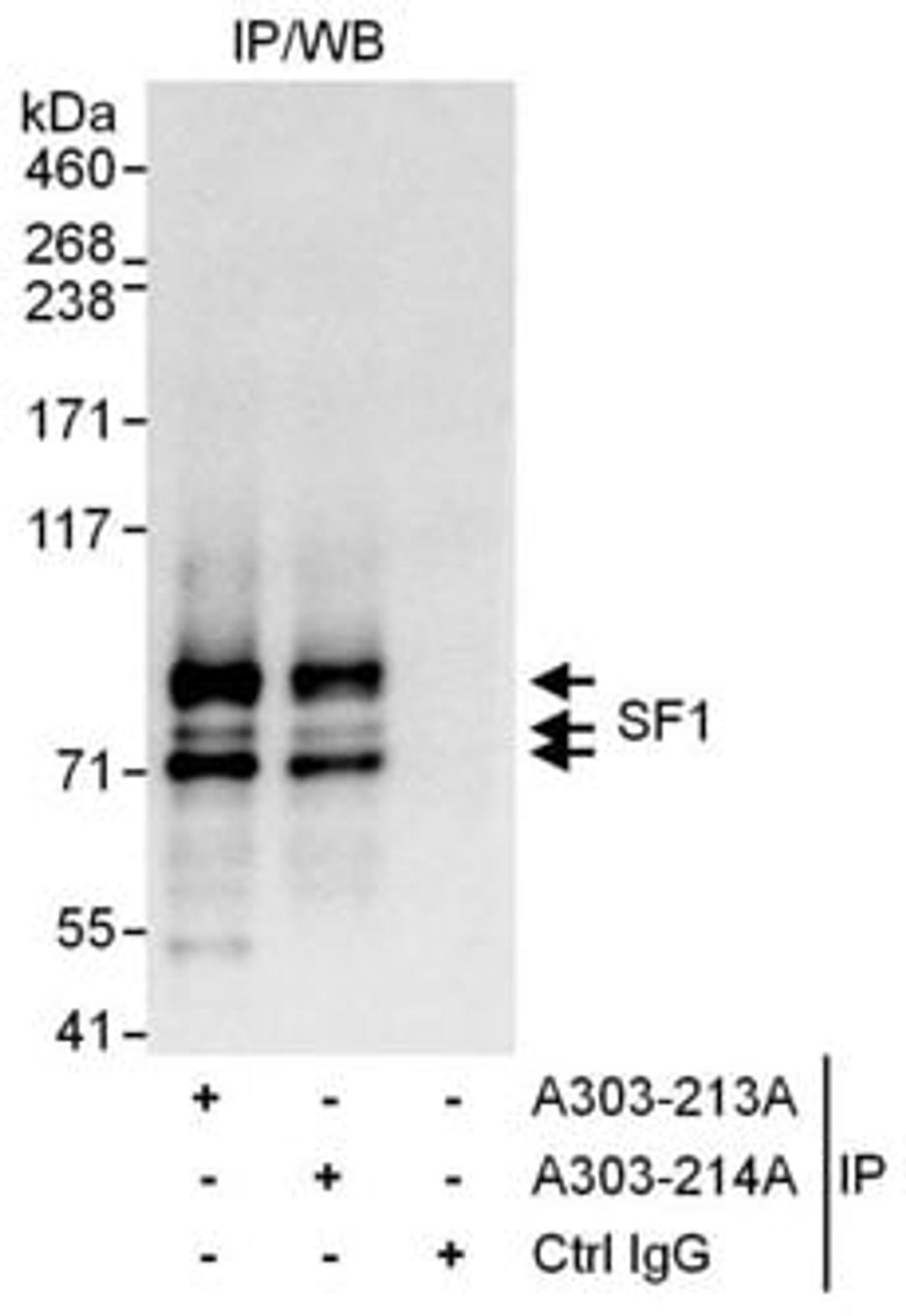 Detection of human SF1 by western blot of immunoprecipitates.