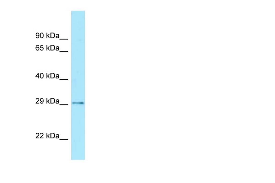 Antibody used in WB on Human Brain lysate at 0.2-1 ug/ml.