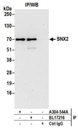 Detection of human SNX2 by western blot of immunoprecipitates.