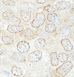 Detection of human NUP50 by immunohistochemistry.