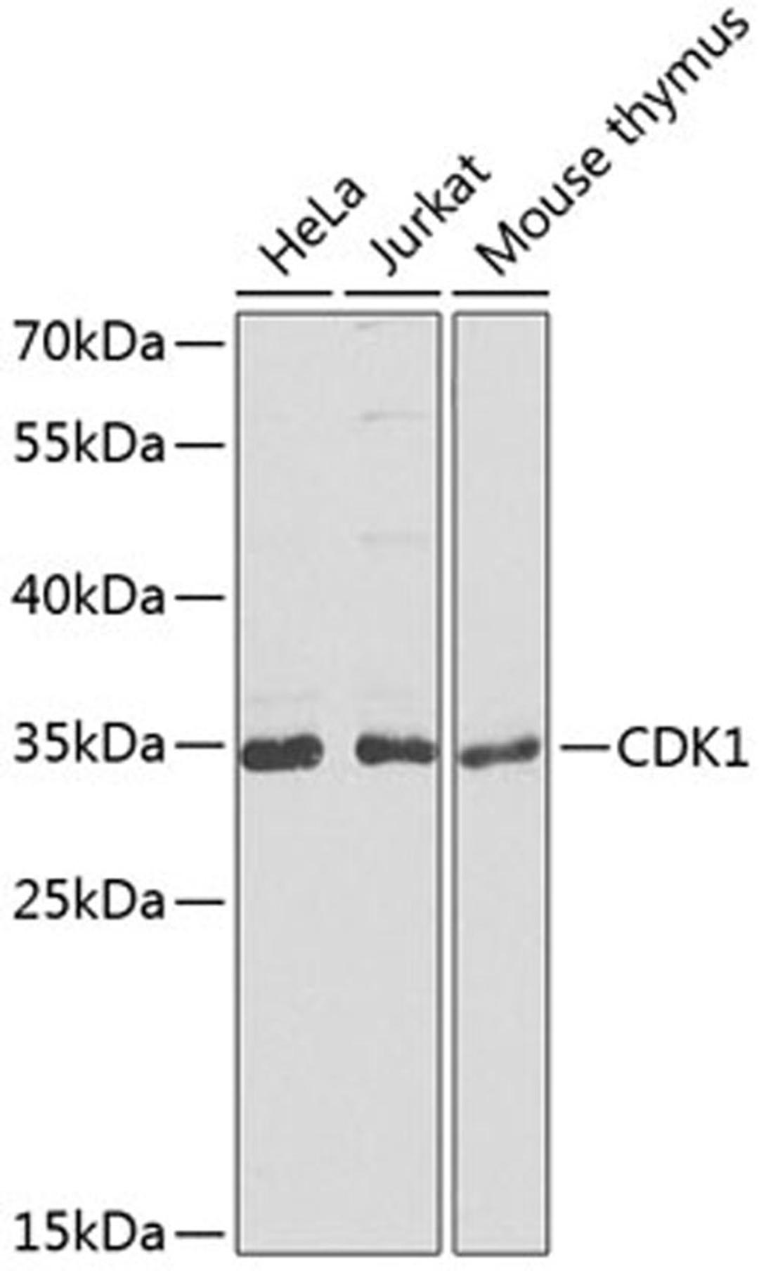 Western blot - CDK1 antibody (A2861)