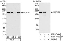 Detection of human NUP153 by western blot and immunoprecipitation.