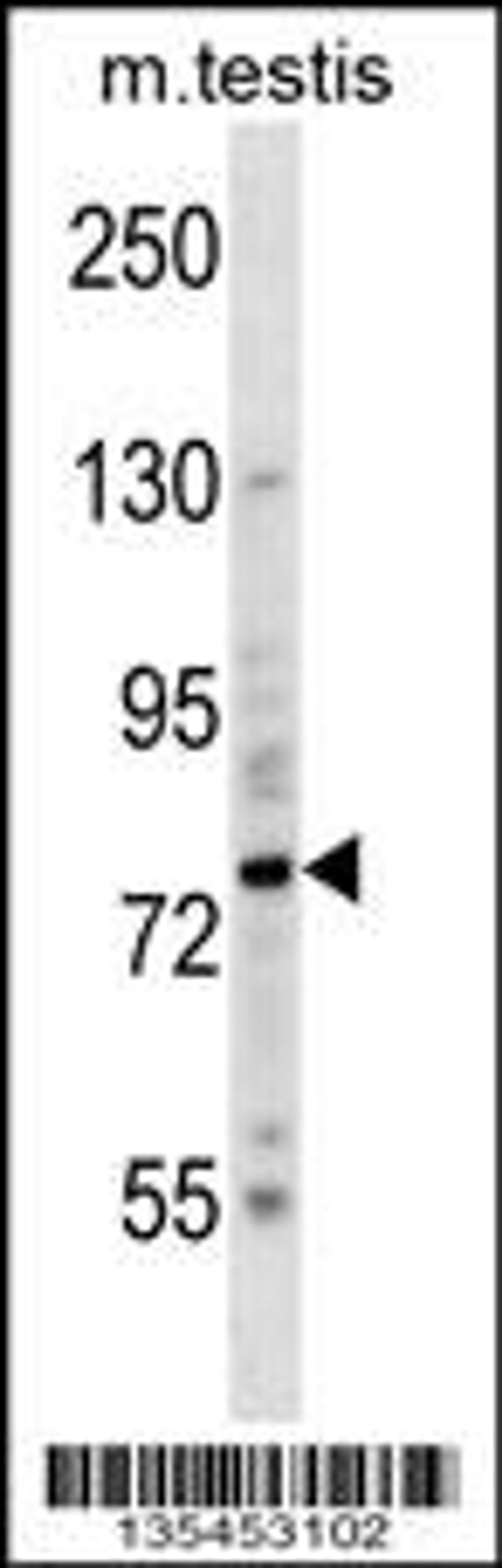 Western blot analysis in mouse testis tissue lysates (35ug/lane).