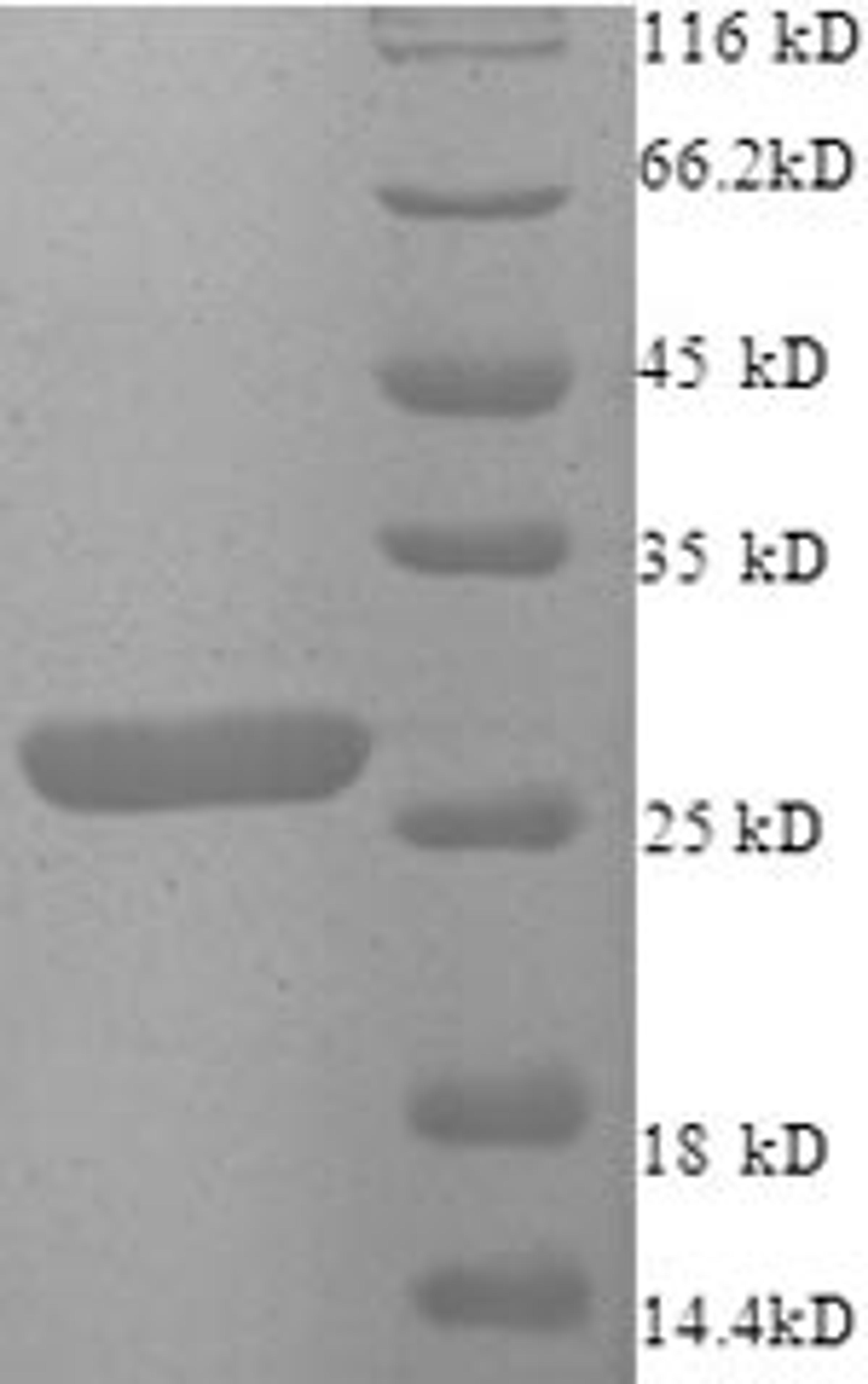 (Tris-Glycine gel) Discontinuous SDS-PAGE (reduced) with 5% enrichment gel and 15% separation gel.