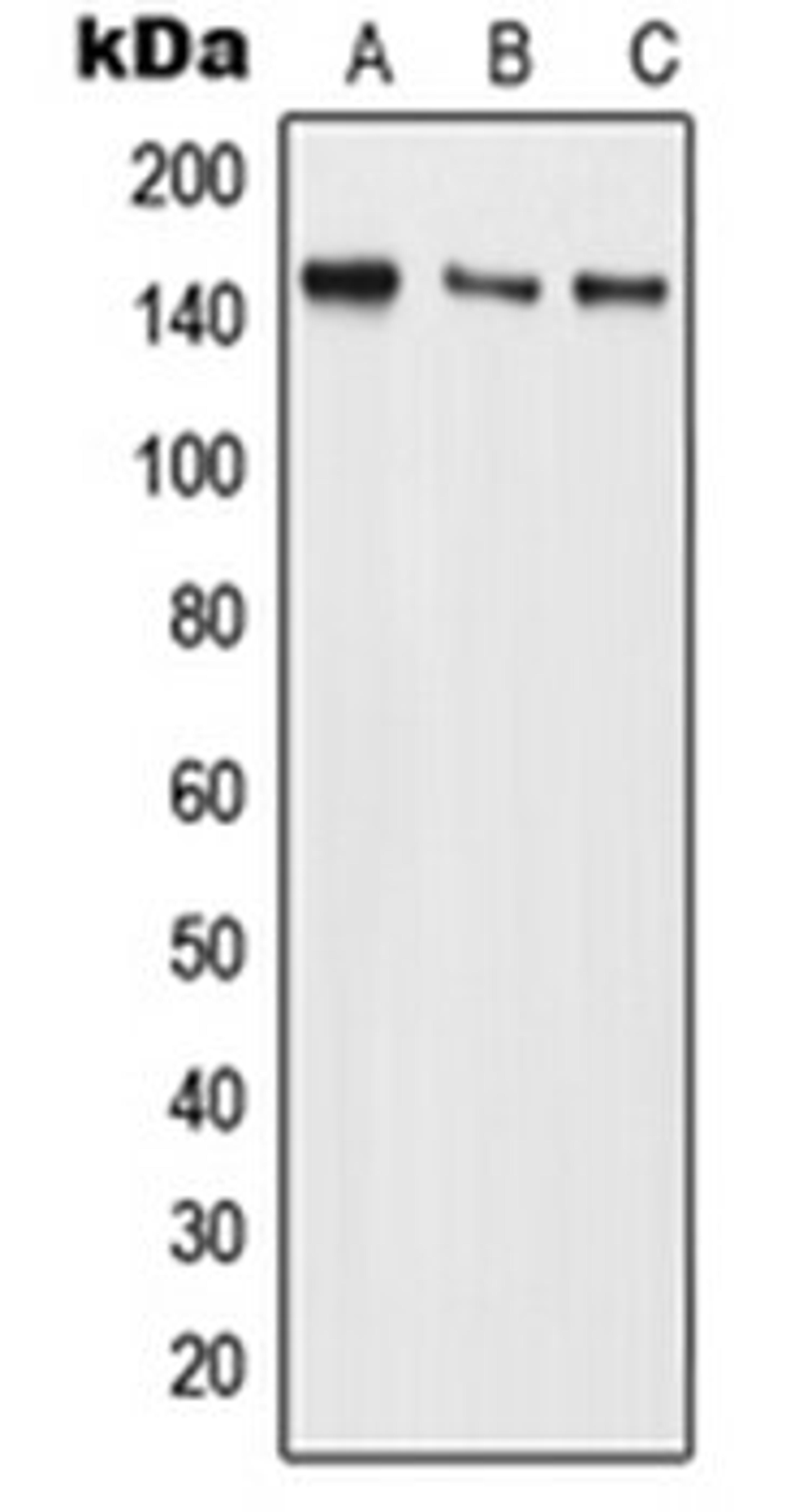 Western blot analysis of MCF7 (Lane 1), Raw264.7 (Lane 2), H9C2 (Lane 3) whole cell lysates using BMS1 antibody