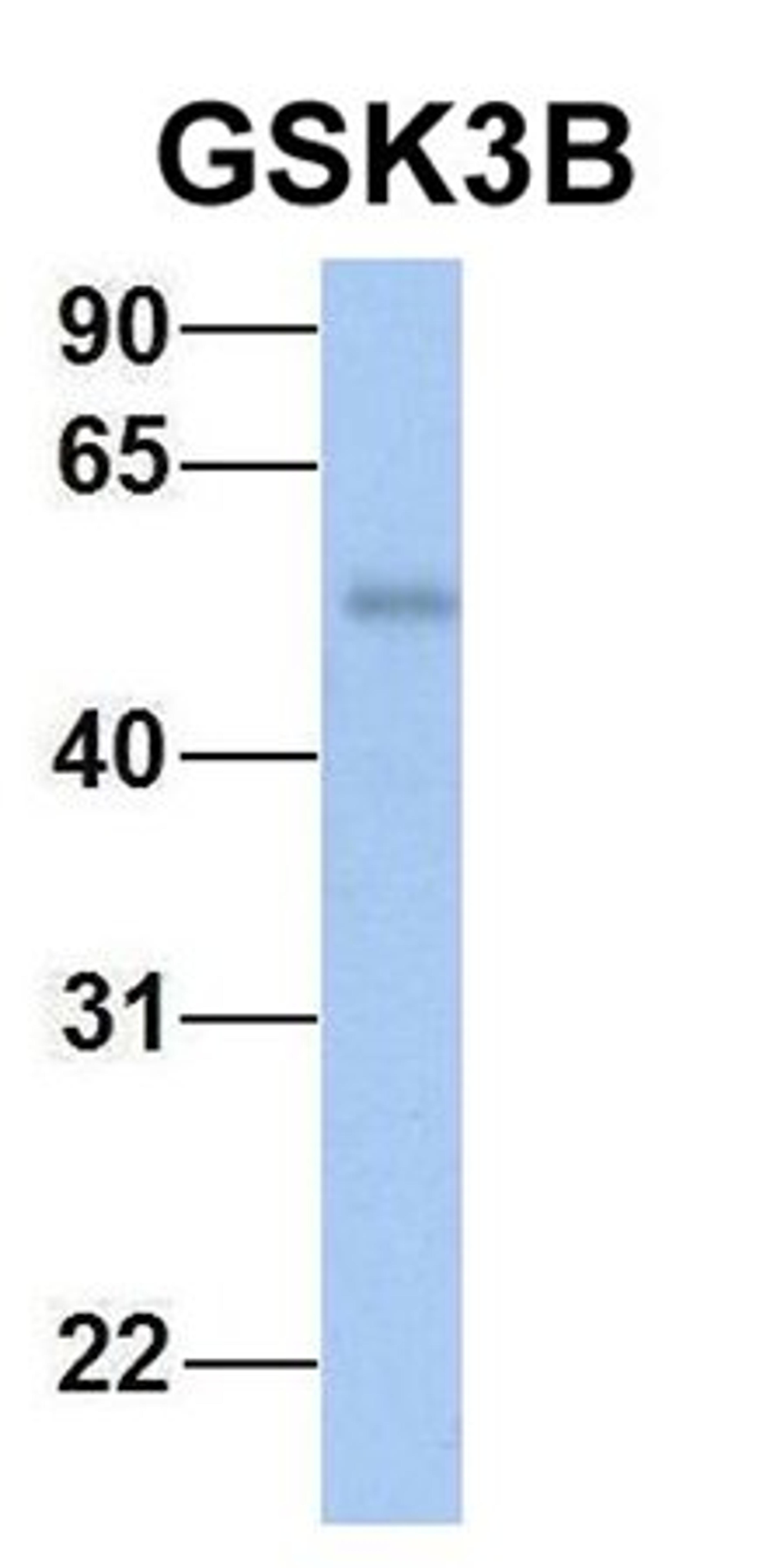 Western blot analysis of human Fetal Heart tissue using GSK3B antibody