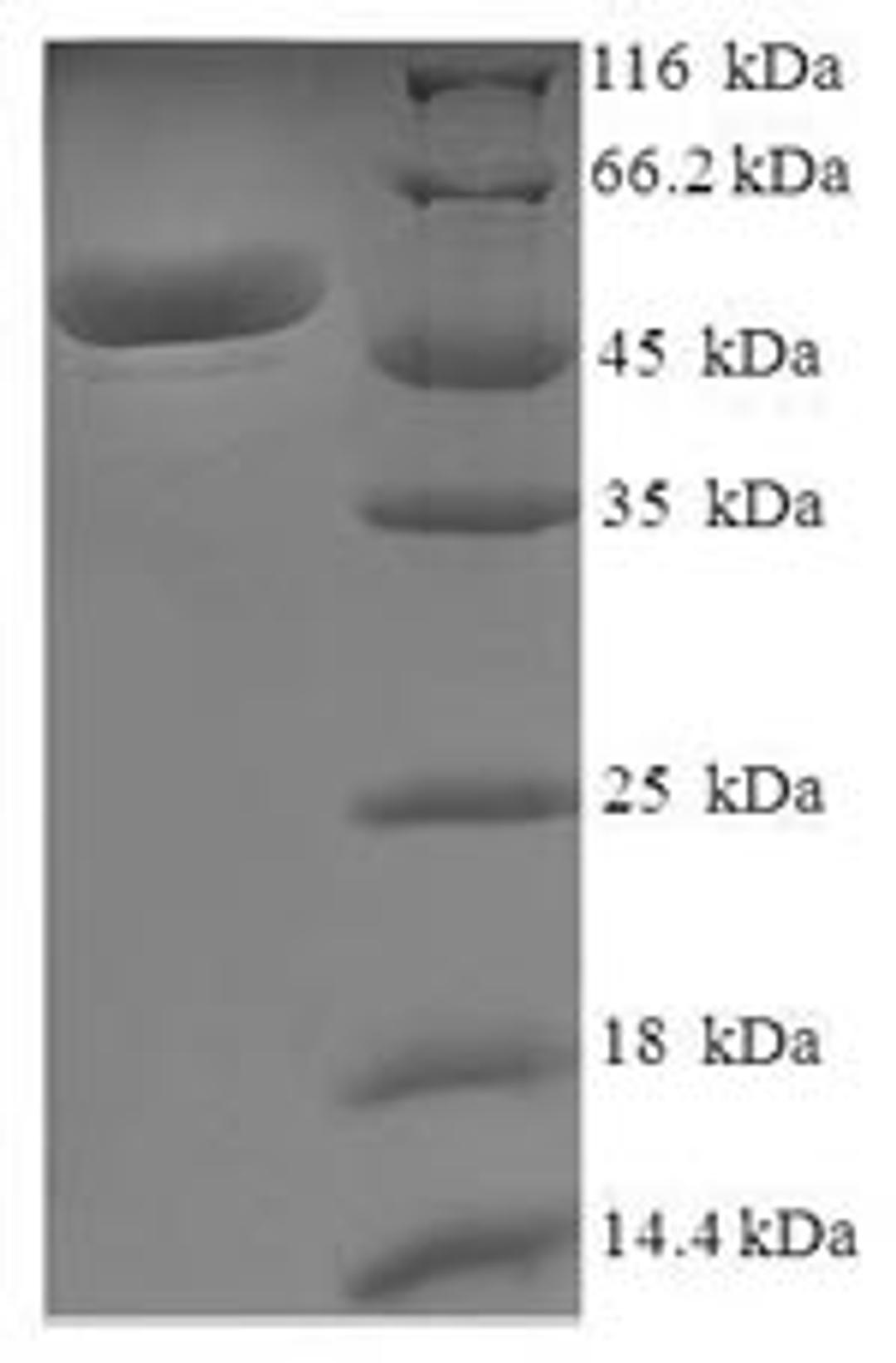 (Tris-Glycine gel) Discontinuous SDS-PAGE (reduced) with 5% enrichment gel and 15% separation gel.