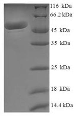 (Tris-Glycine gel) Discontinuous SDS-PAGE (reduced) with 5% enrichment gel and 15% separation gel.