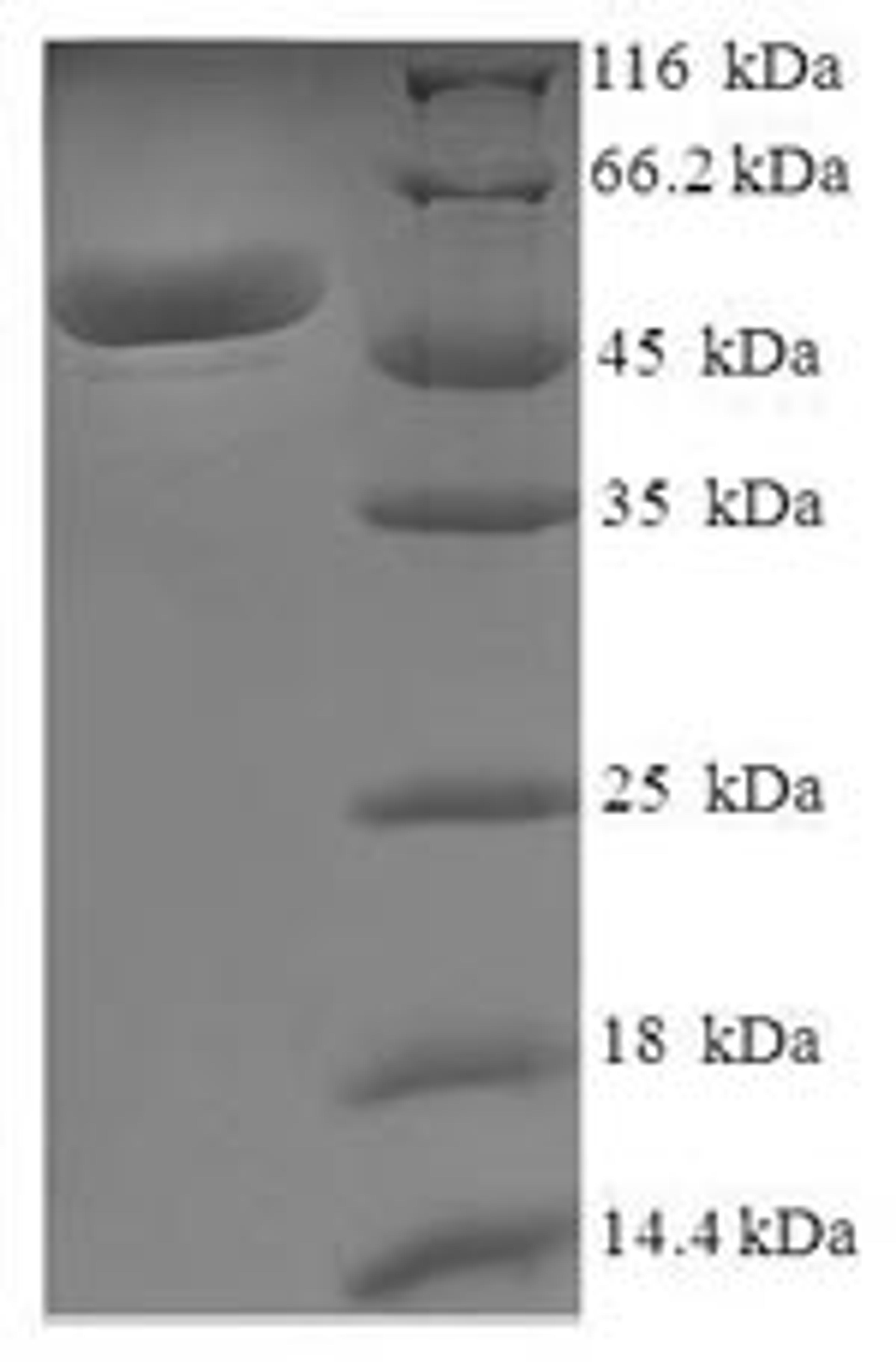 (Tris-Glycine gel) Discontinuous SDS-PAGE (reduced) with 5% enrichment gel and 15% separation gel.