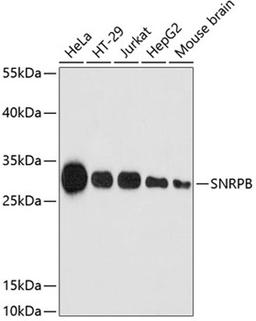 Western blot - SNRPB antibody (A2009)