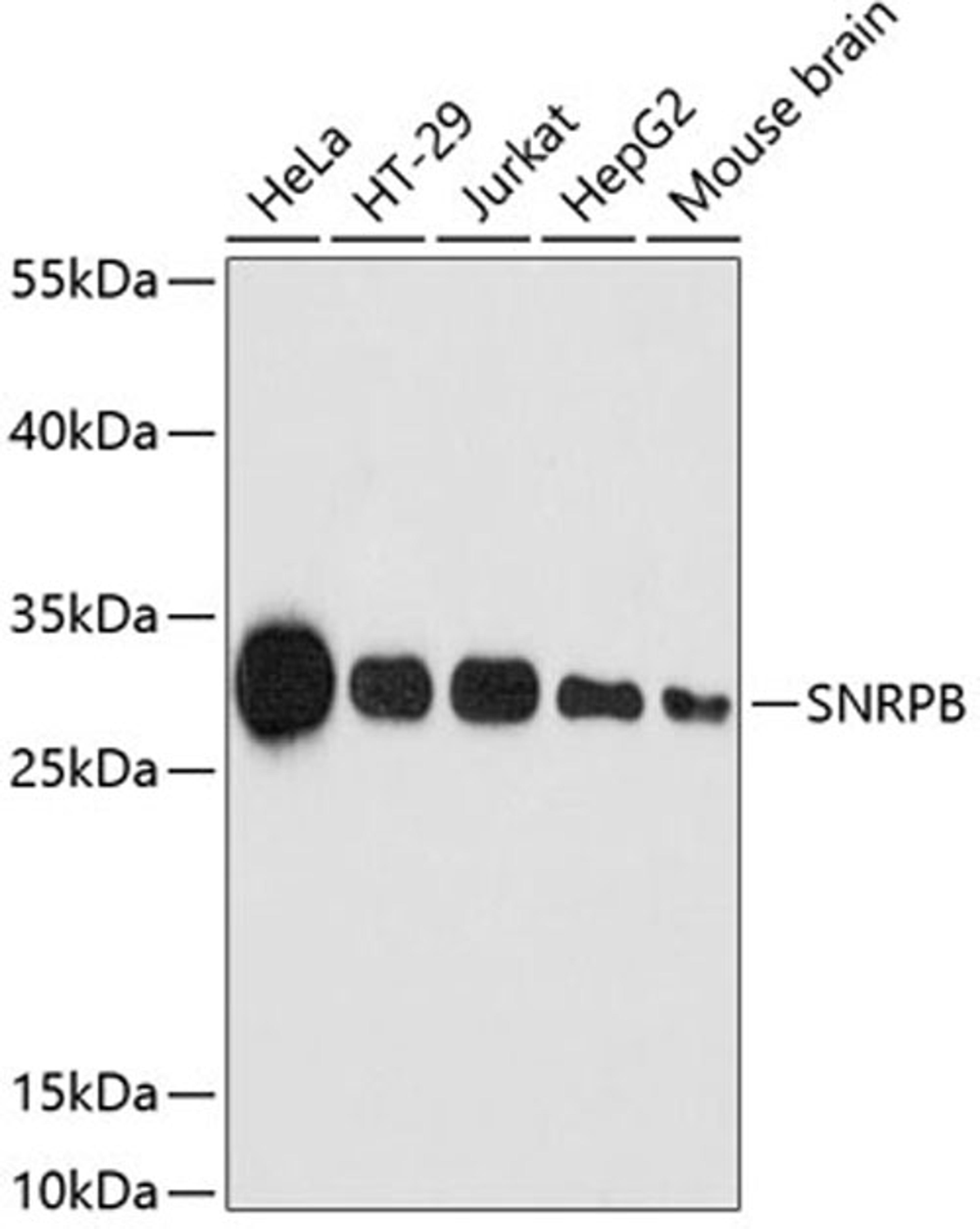 Western blot - SNRPB antibody (A2009)