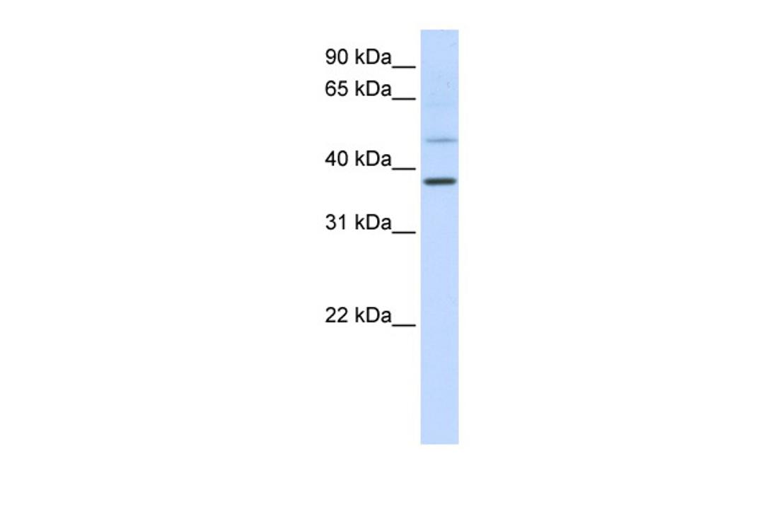 Antibody used in WB on Human HeLa at 0.2-1 ug/ml.