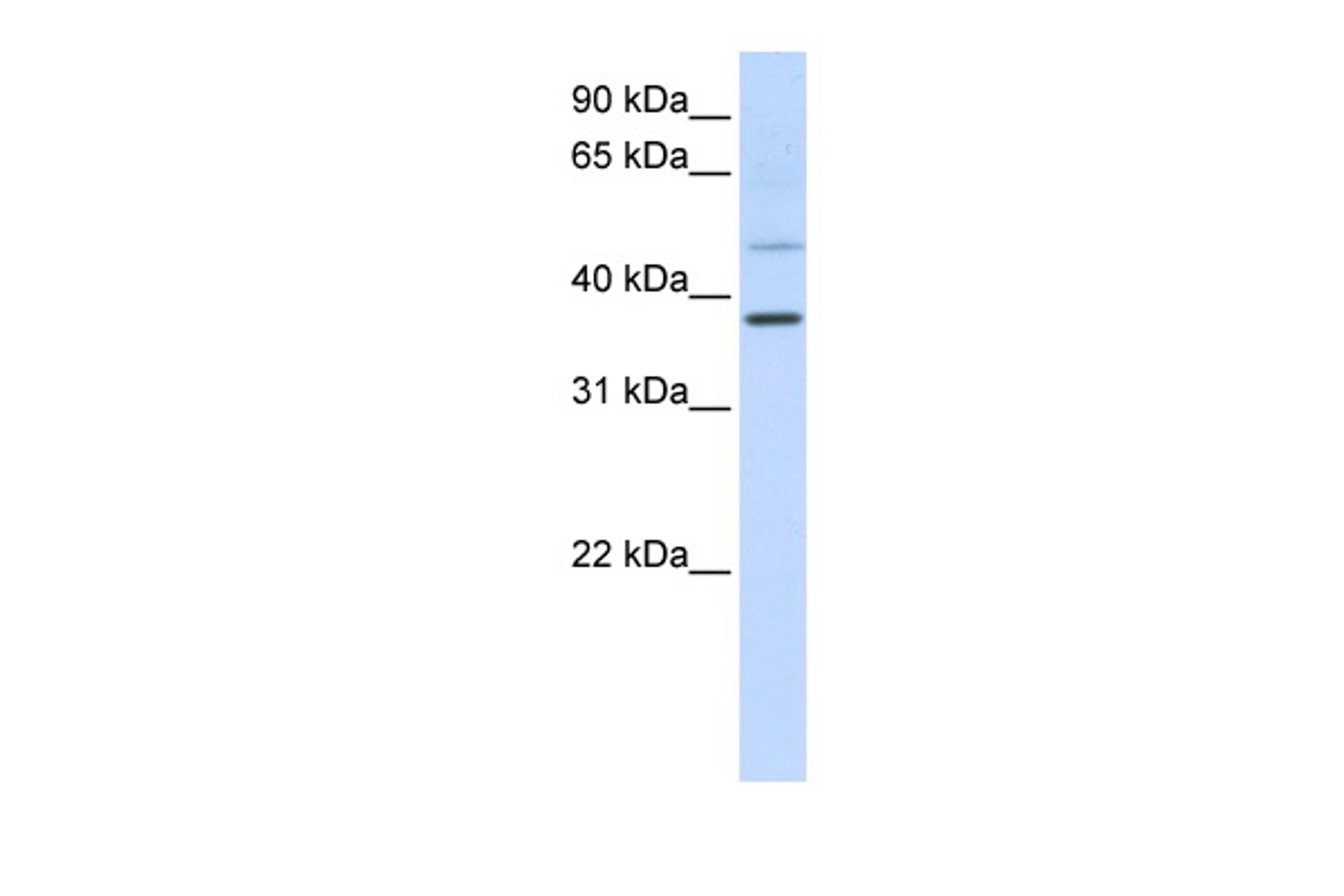 Antibody used in WB on Human HeLa at 0.2-1 ug/ml.