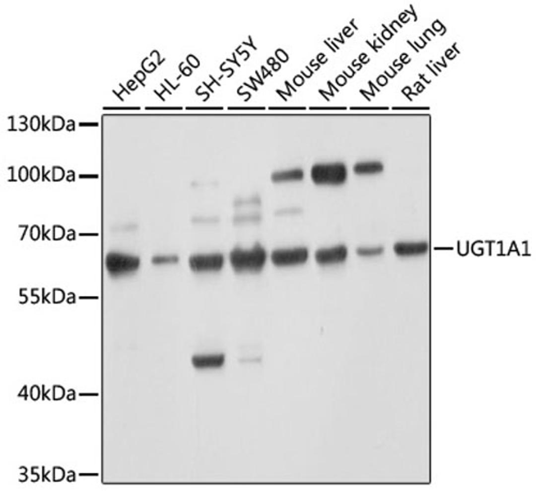 Western blot - UGT1A1 antibody (A1359)